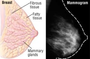 What Is a Mammogram - Rohilkhand Cancer Institute | Pet CT Scan in Bareilly 
