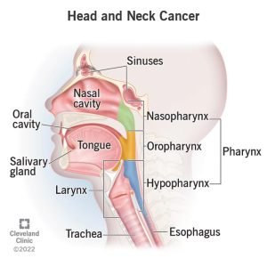 Head and neck cancers symptoms - Rohilkhand Cancer Institute | Pet CT Scan in Bareilly