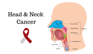 Head and neck cancers symptoms - Rohilkhand Cancer Institute | Pet CT Scan in Bareilly