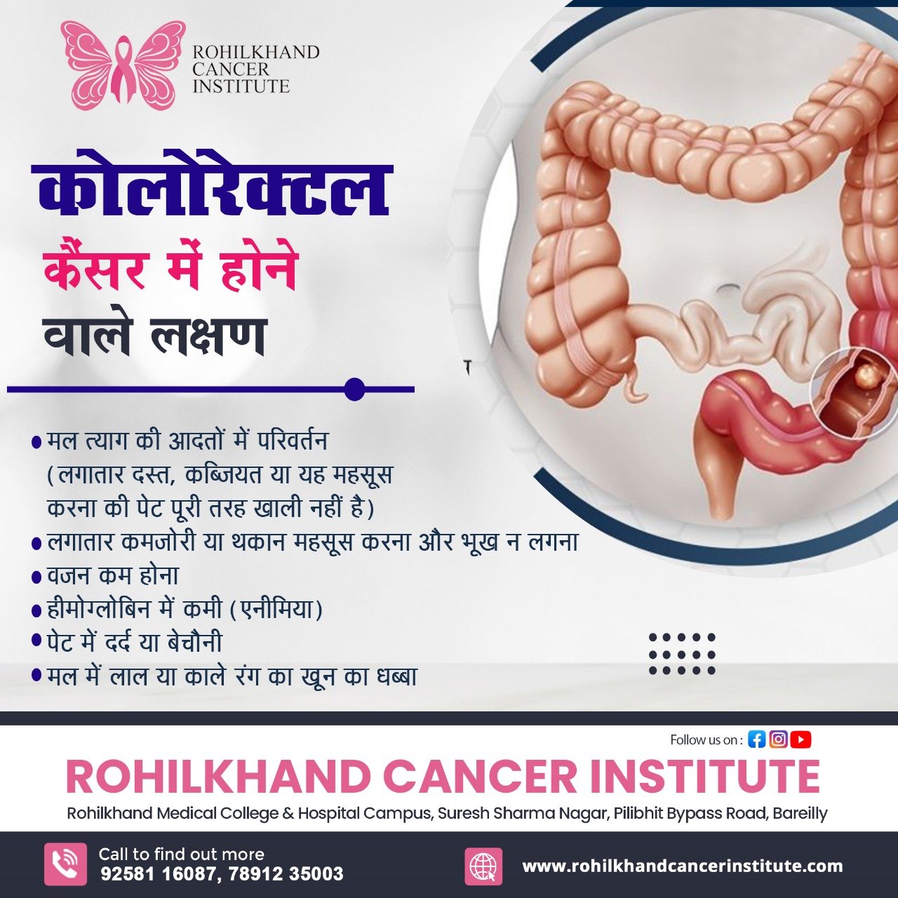 Colon Cancer Signs And Symptoms - Rohilkhand Cancer Institute | Pet CT Scan in Bareilly