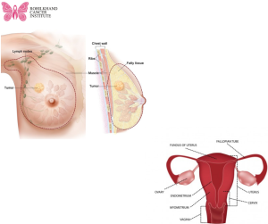 मुंह जीभ व गले का कैंसर स्तन व बच्चेदानी का कैंसर पेट व आंतों का कैंसर फेफड़ों व ब्लड कैंसर- Rohilkhand Cancer Institute | Pet CT Scan in Bareilly