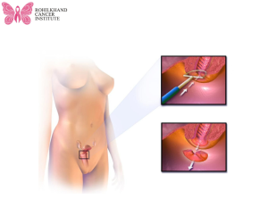 सर्वाइकल कैंसर - Rohilkhand Cancer Institute Pet CT Scan in Bareilly - (3)