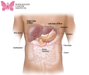 Liver Cancer - Rohilkhand Cancer Institute Pet CT Scan in Bareilly 