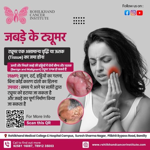 जबड़े के ट्यूमर लक्षण और कारण और उपचार - Rohilkhand Cancer Institute | Pet CT Scan in Bareilly