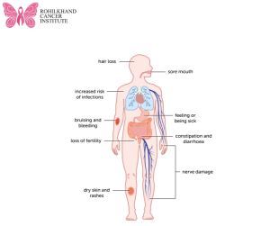 Chemotherapy in Bareilly - Rohilkhand Cancer Institute Pet CT Scan in Bareilly 