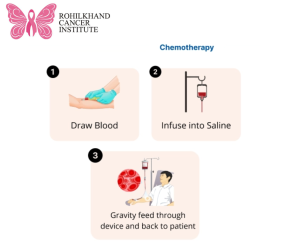 Chemotherapy in Bareilly - Rohilkhand Cancer Institute Pet CT Scan in Bareilly