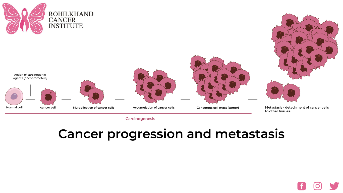 Advanced cancer treatments Bareilly