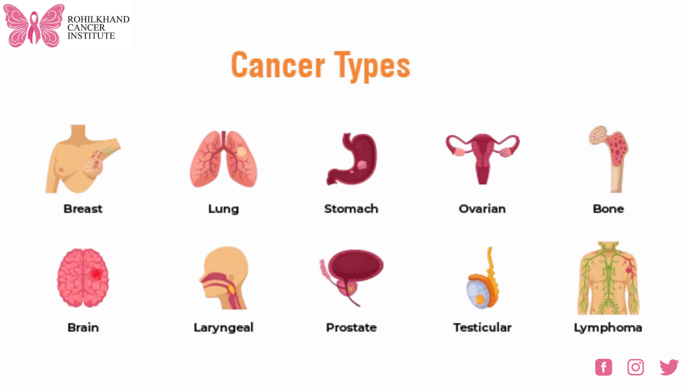 Advanced cancer treatments Bareilly 