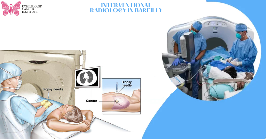 Interventional radiology in bareilly