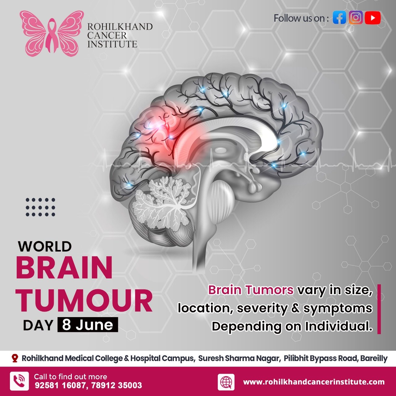 Tumor removal surgery Bareilly