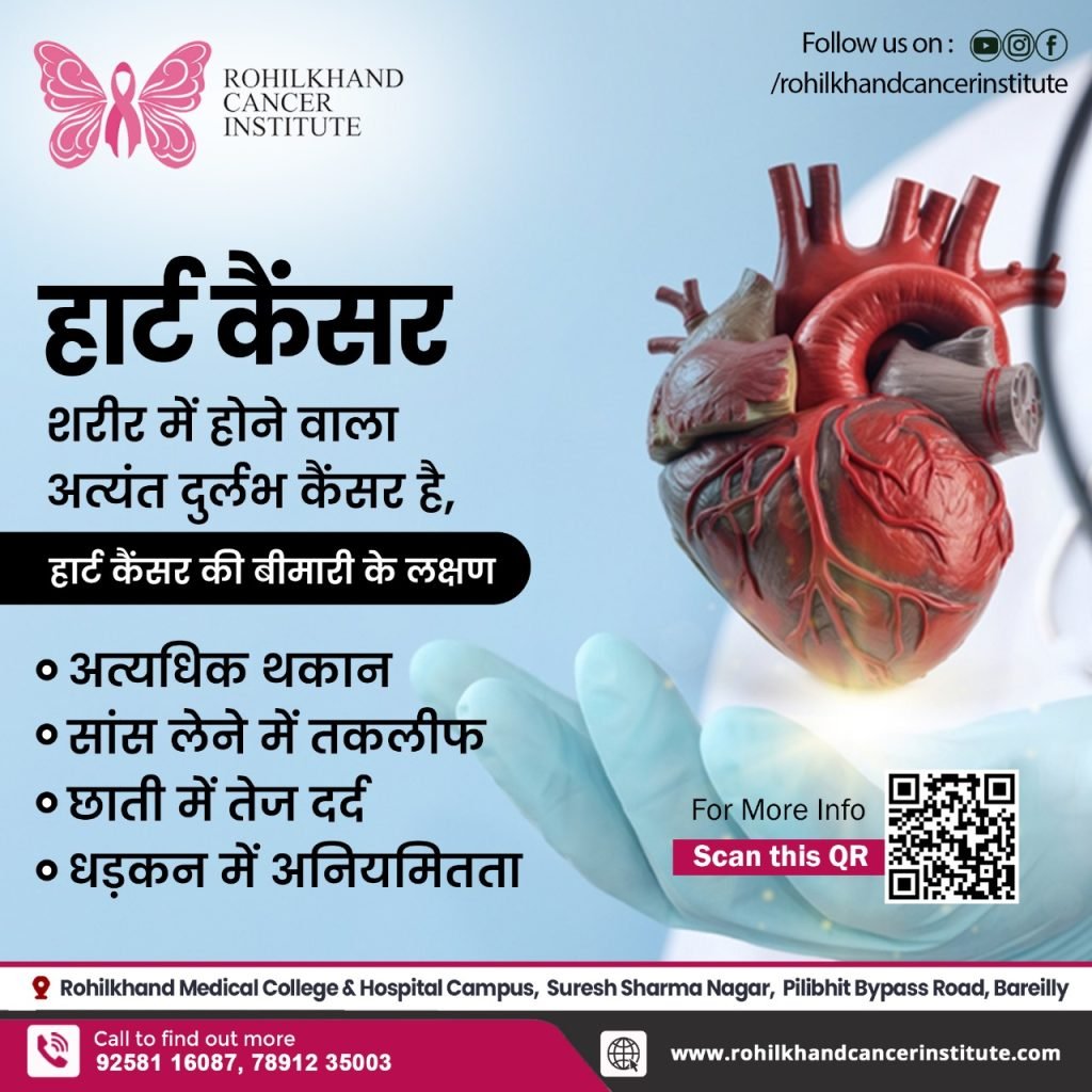 Tumor embolization Bareilly