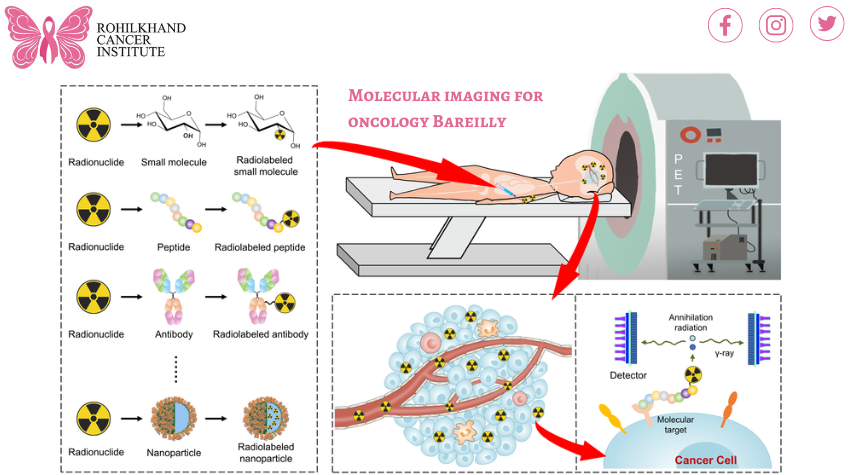 Molecular imaging for oncology Bareilly