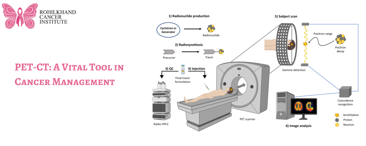Nuclear medicine for cancer Bareilly 