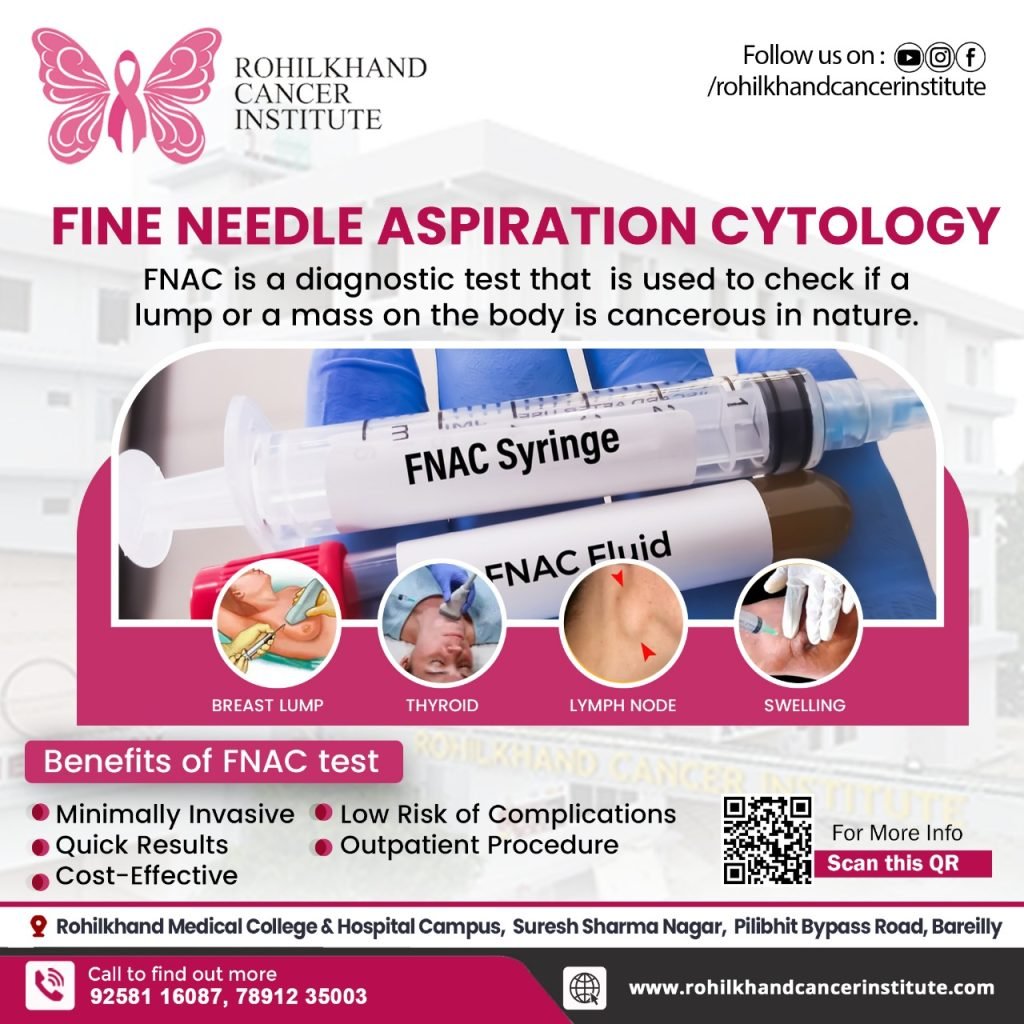 Cancer test near me in bareilly