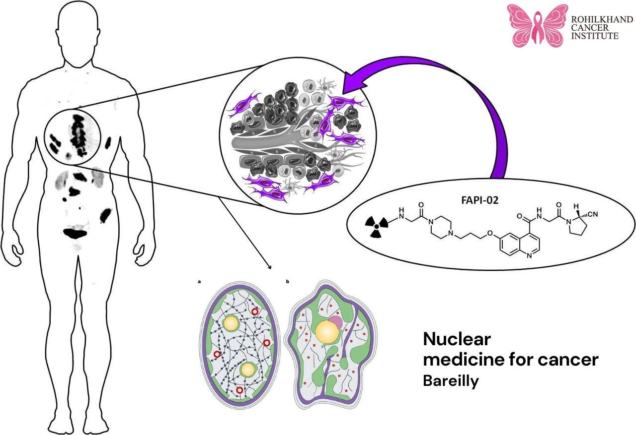 Nuclear medicine for cancer Bareilly
