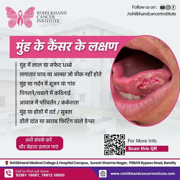 Oral Cancer मुंह के कैंसर के लक्षण