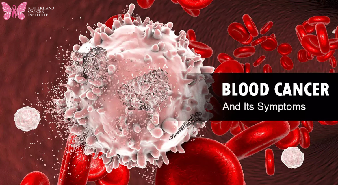 ब्लड कैंसर को ऐसे पहचानें