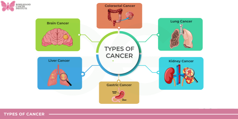 Rohilkhand Cancer Institute: Your Reliable Cancer Hospital in Uttarakhand