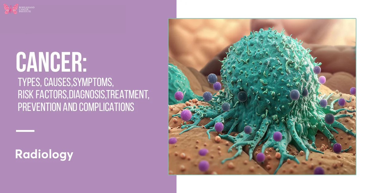 Best Cancer Specialist in Budaun – Rohilkhand Cancer Institute You Can Rely On