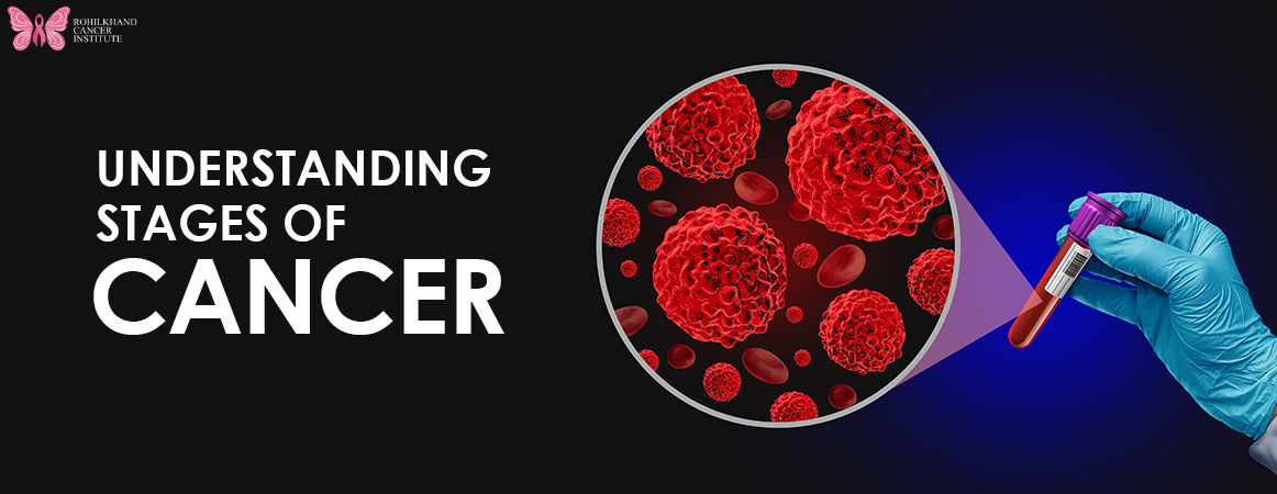 Rohilkhand Cancer Institute: Your Trusted Cancer Hospital in Uttar Pradesh