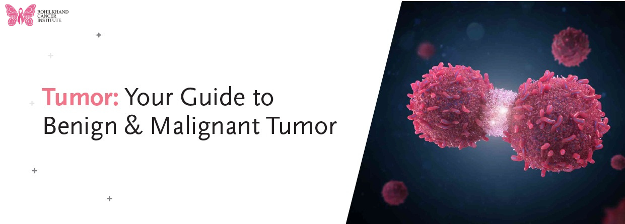 Best Oncologist in Uttarakhand – Trusted Cancer Care at Rohilkhand Cancer Institute
