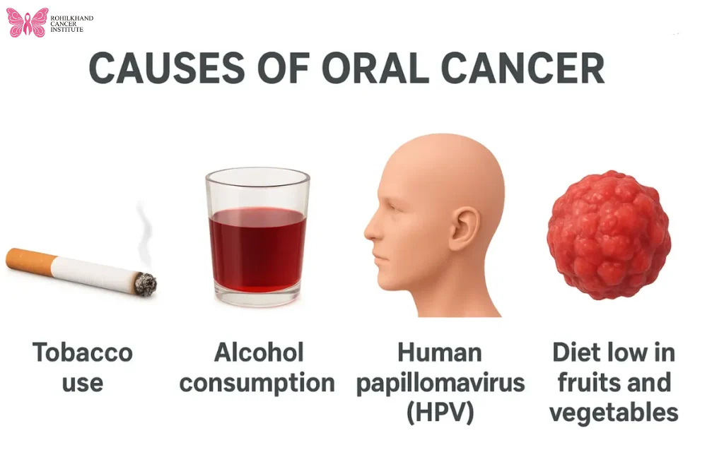 Oral Oncology Treatment in Uttar Pradesh: Expert Care at Rohilkhand Cancer Institute