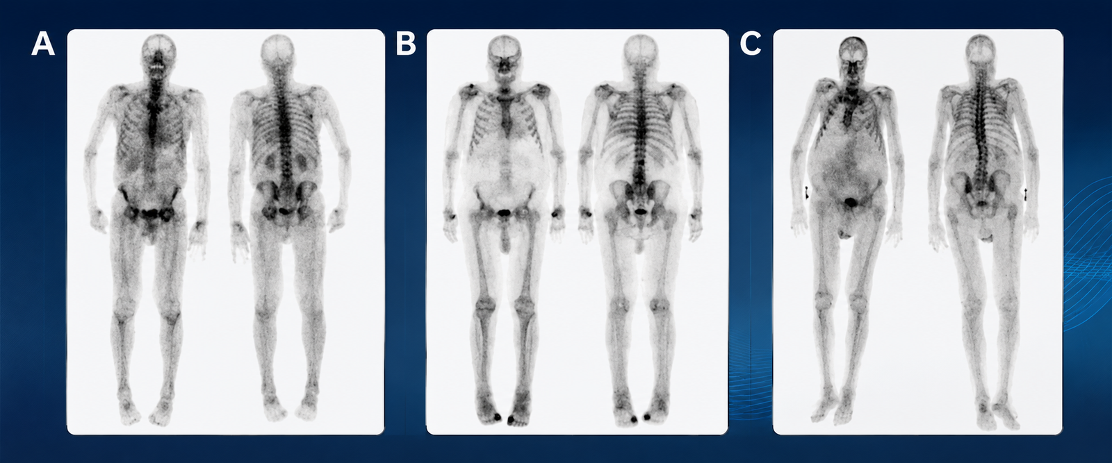 Nuclear Medicine PET-CT in Bhojipura, Uttar Pradesh | Advanced Diagnostic Care at Rohilkhand Cancer Institute