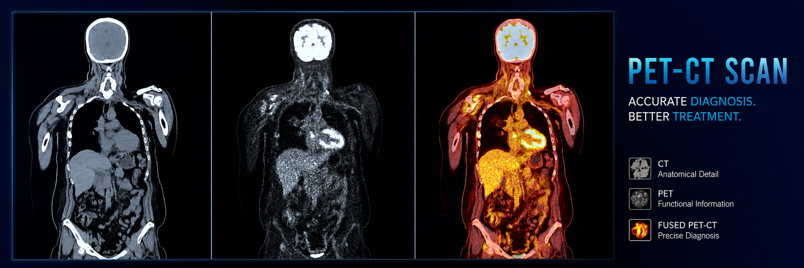 PET-CT in Bhojipura, Uttar Pradesh – Trusted Cancer Imaging at Rohilkhand Cancer Institute