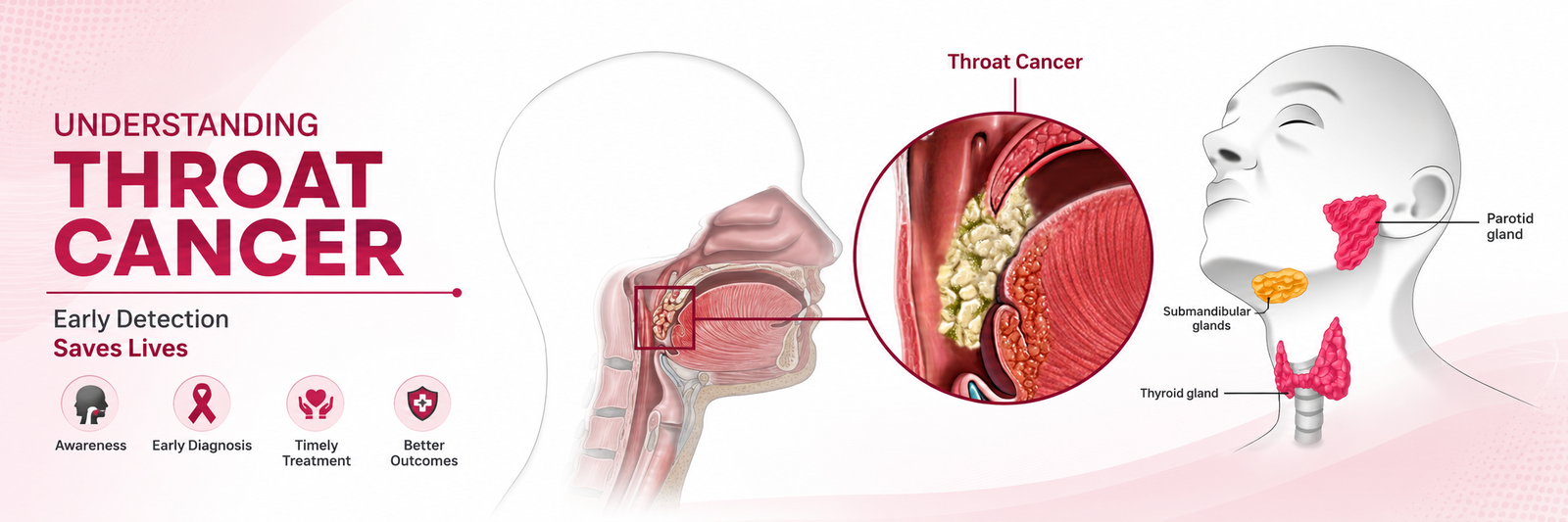 Best Head and Neck Cancer Treatment in Bhojipura, Uttar Pradesh – Rohilkhand Cancer Institute