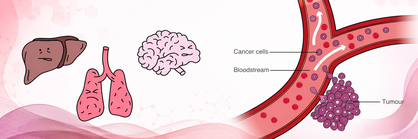 Best Cancer Doctor in Milak, UP | Expert Cancer Care at Rohilkhand Cancer Institute