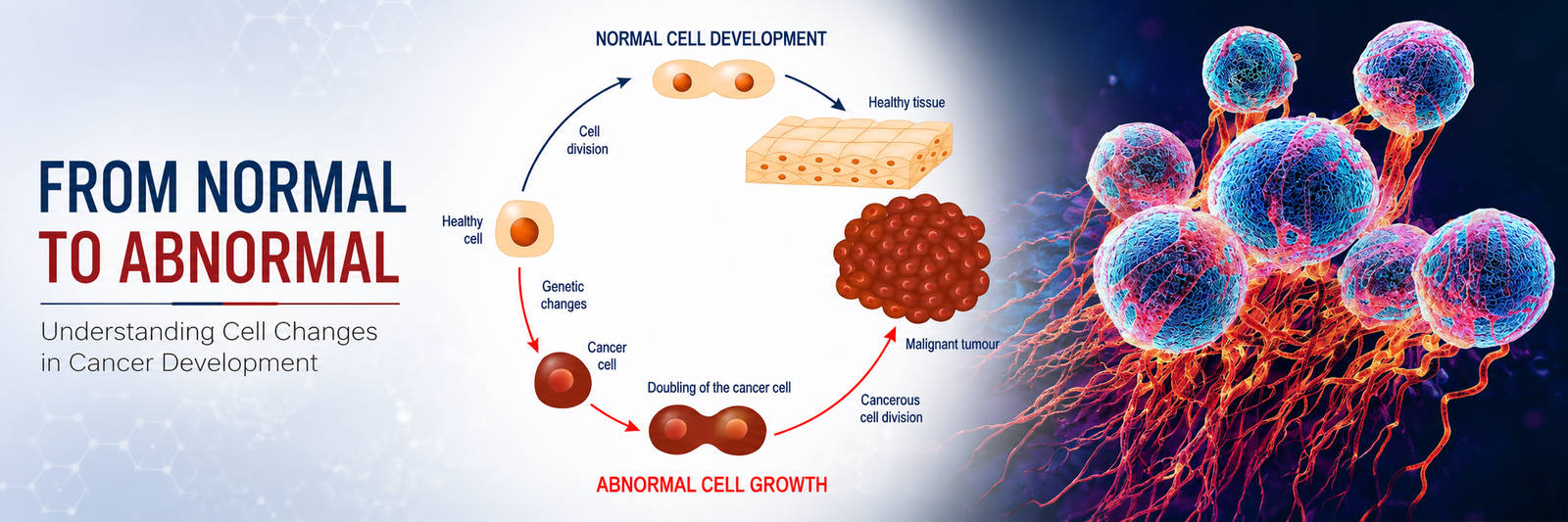 Holistic Cancer Care Approach in Milak, Uttar Pradesh | Rohilkhand Cancer Institute