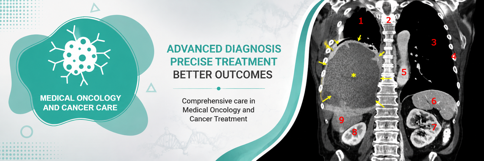 Medical Oncology Hospital in Milak, Uttar Pradesh | Comprehensive Cancer Care & Treatment